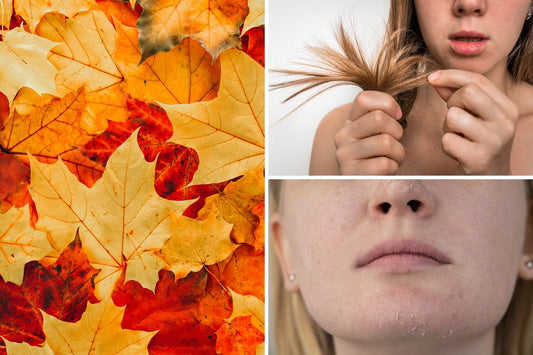 Why Your Skin & Hair Are Freaking Out This Autumn