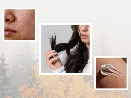Why Your Skin & Hair Are Freaking Out This Autumn