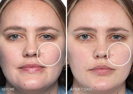 Caudalie Vinoperfect Serum before and after