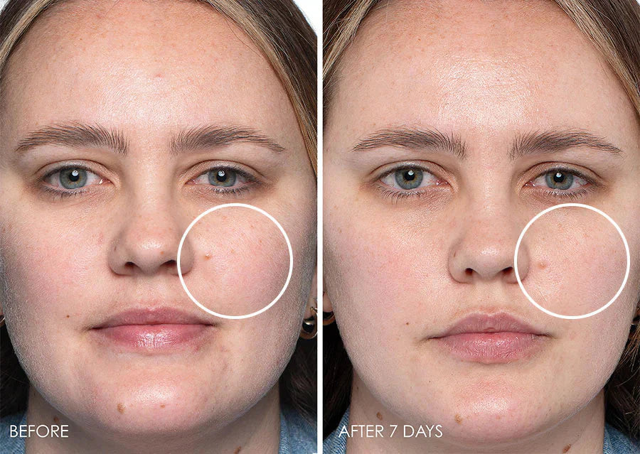 Caudalie Vinoperfect Serum before and after