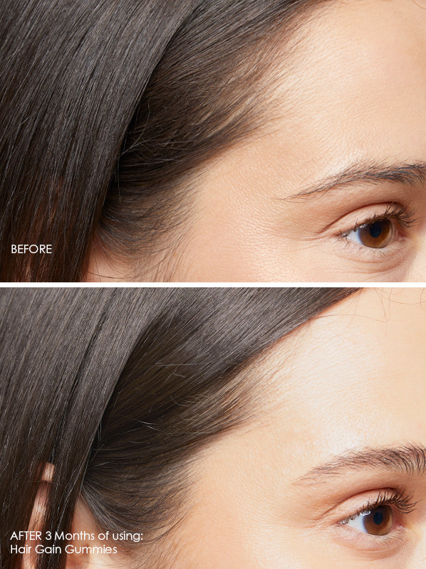 Hair Gain Hair Gummies 3 Month Review