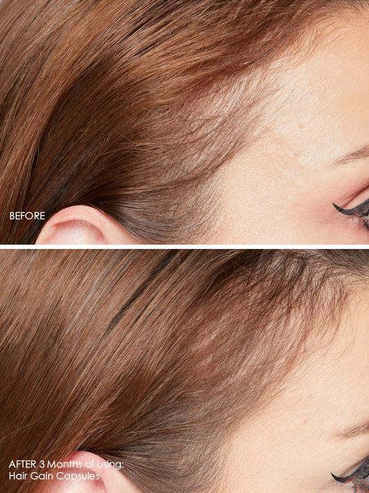 Hair Gain Hair Capsules 3 Month Review