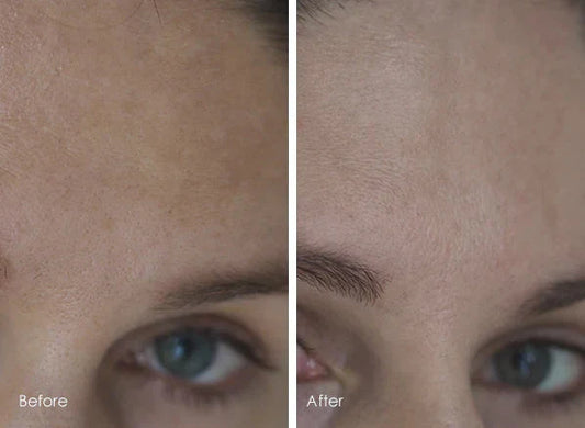 How I Reduced my Pigmentation in 4 Weeks Using Bioderma Pigmentbio