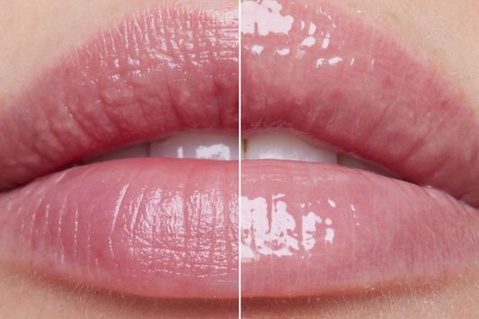 The Ordinary Squalane + Amino Acids Lip Balm Review