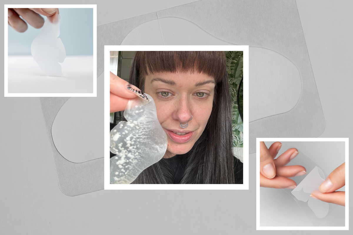 Vue Nose Patches Review with Before And after