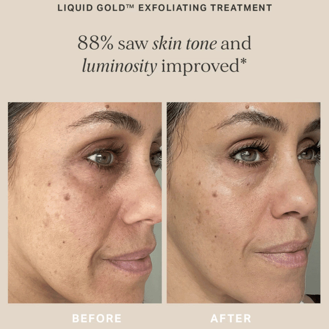 Alpha-H Liquid Gold Exfoliating Treatment with 5% Glycolic Acid
