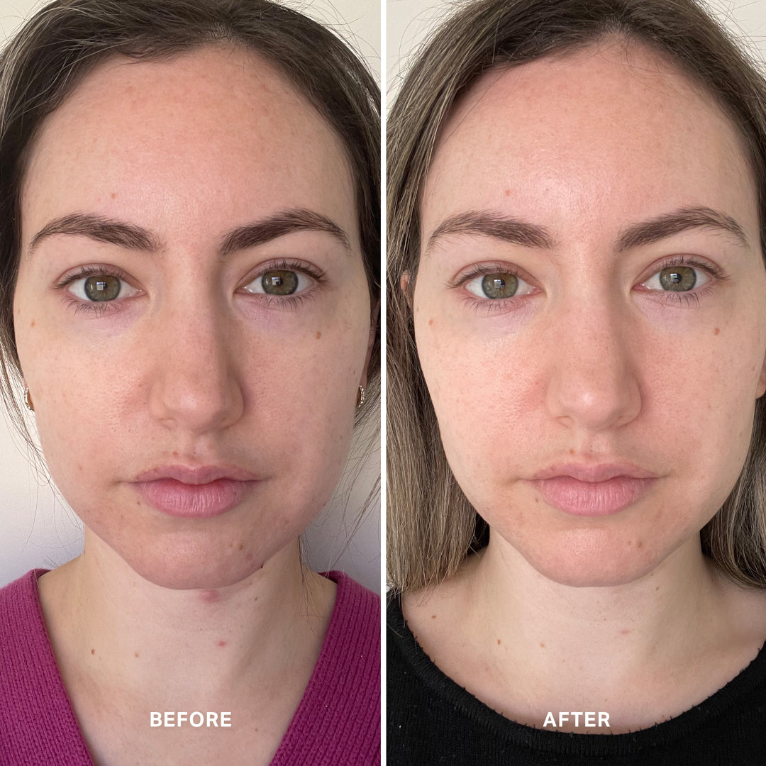 Alpha-H Vitamin B Serum with 5% Niacinamide