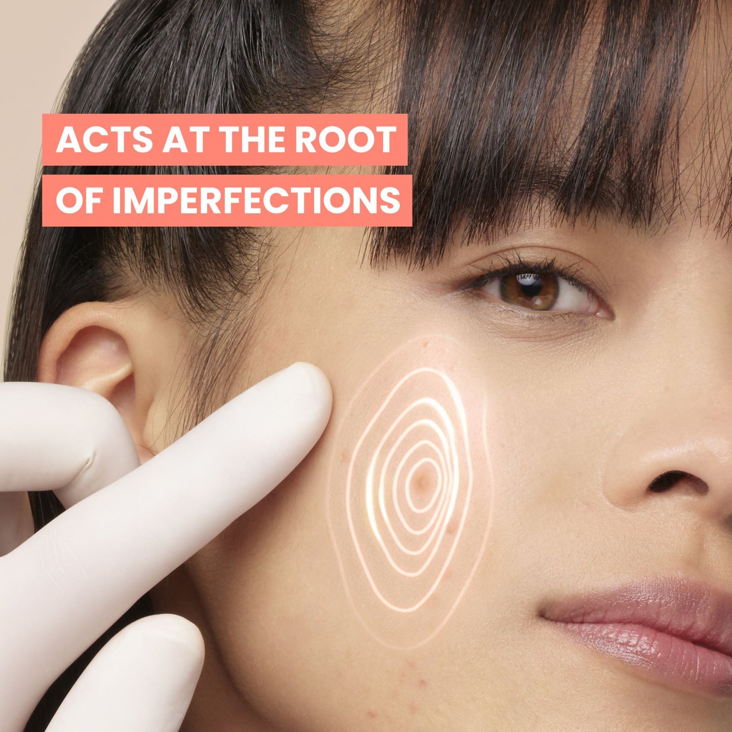 avene0154