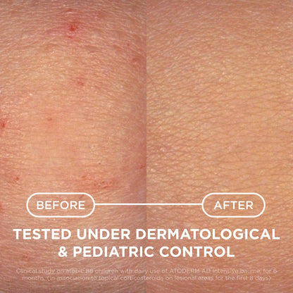 bioderma074