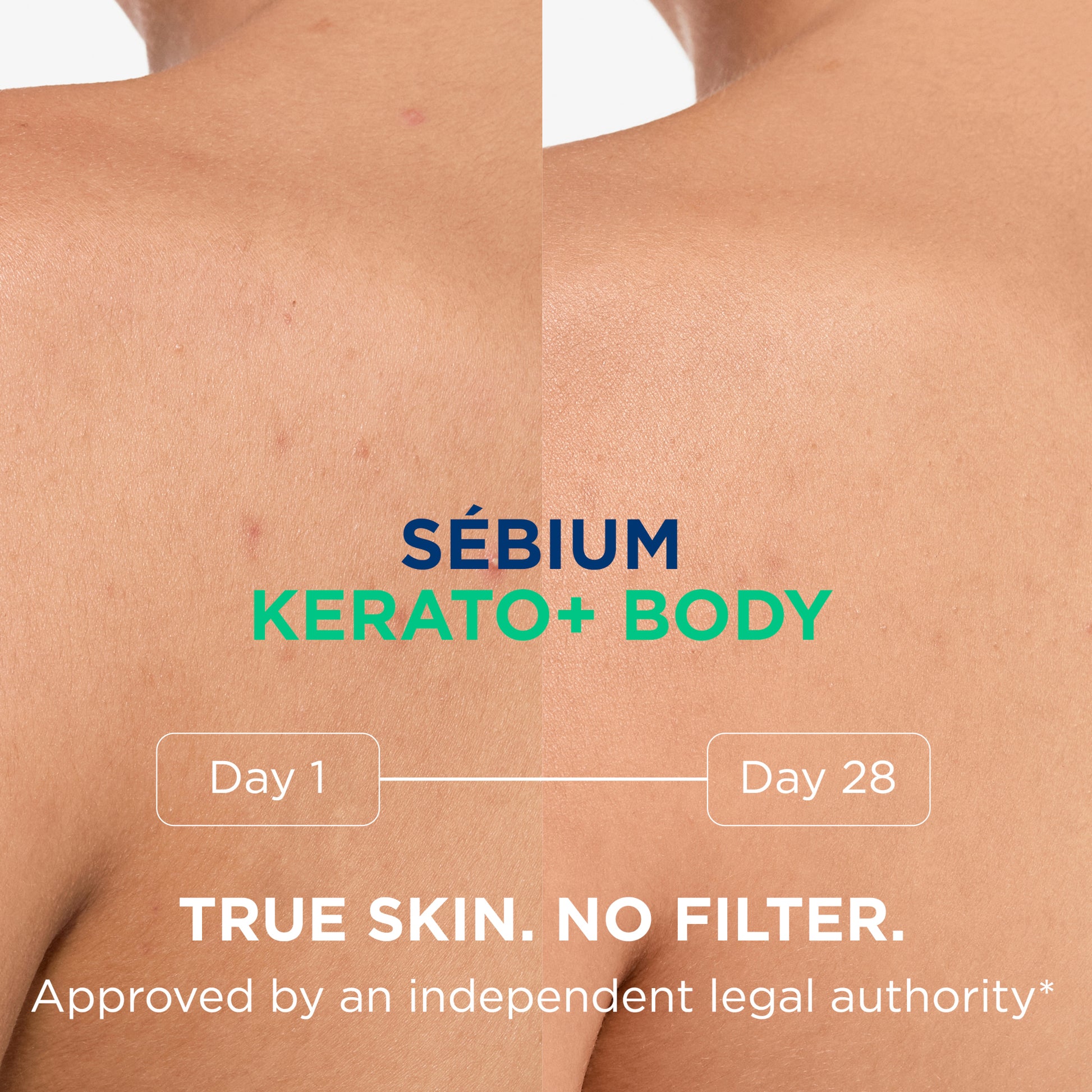 Bioderma Sebium Kerato+ Body Anti Blemish Spray