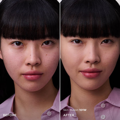 skinillusion002-1004