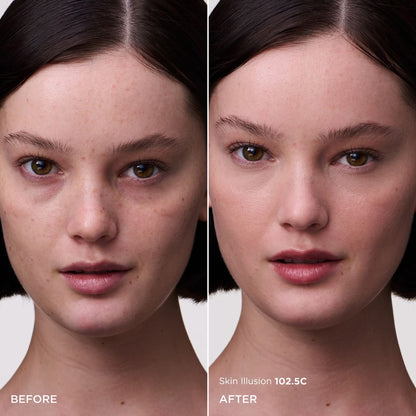 skinillusion002-1001