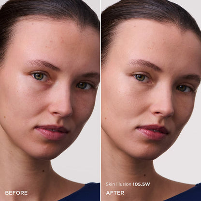 skinillusion002-1015