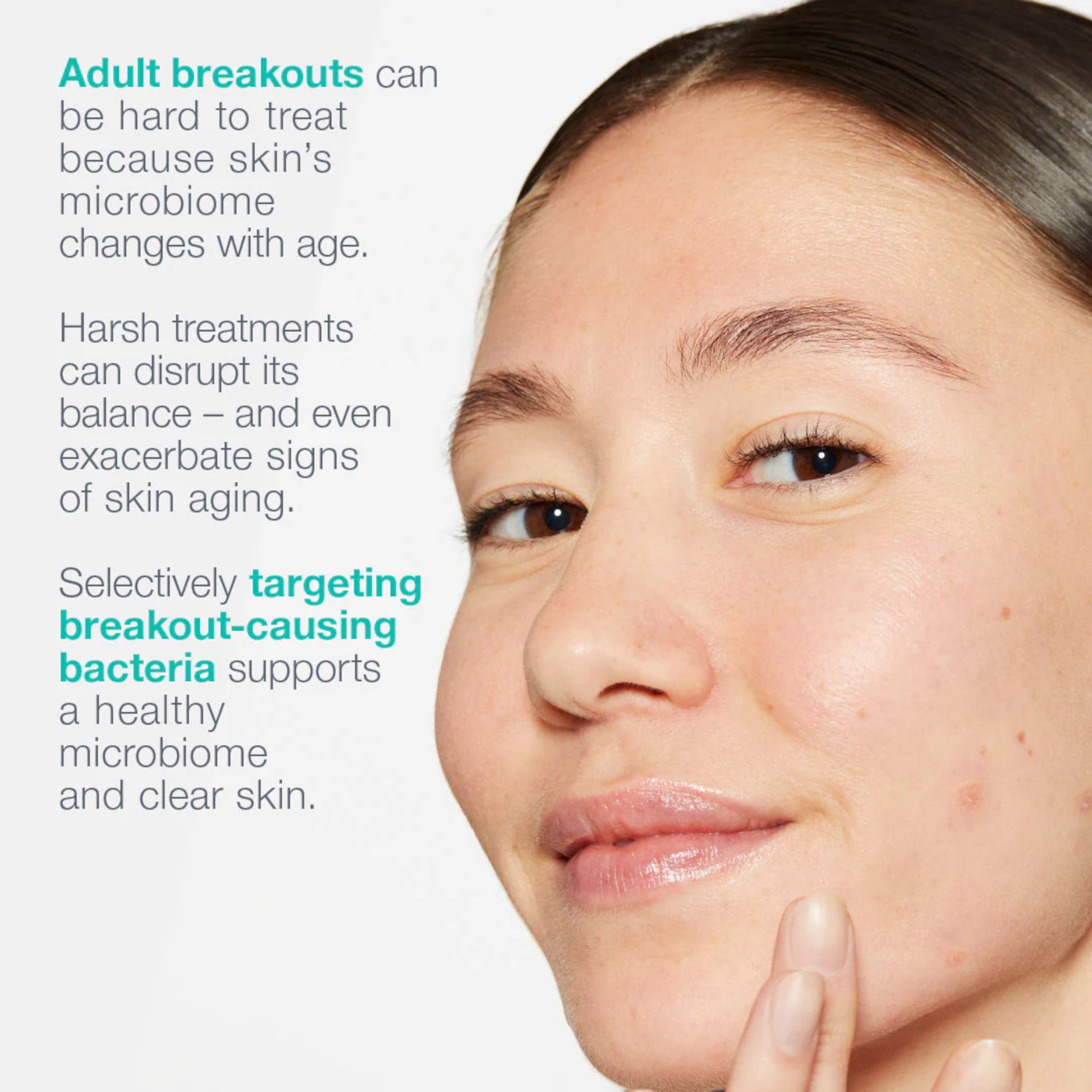 Dermalogica Active Clearing Breakout Biotic Moisturiser