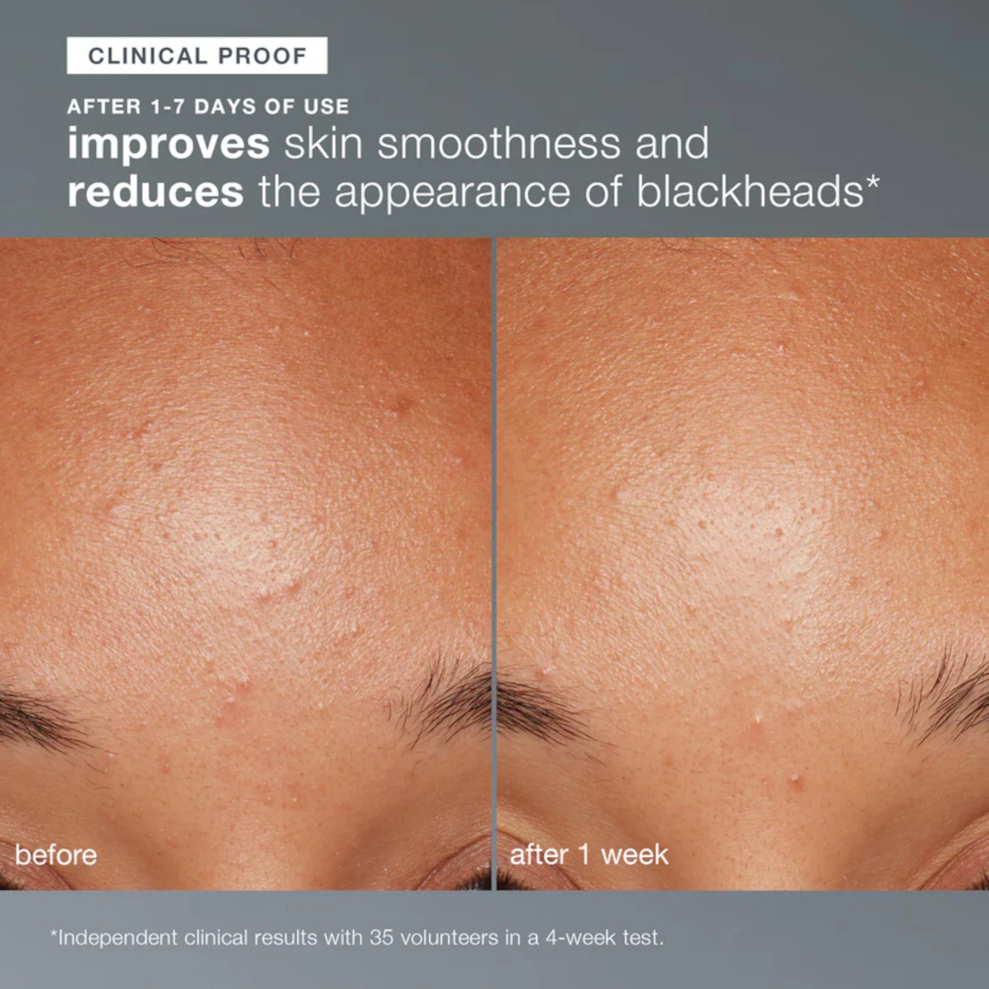Dermalogica Daily Microfoliant