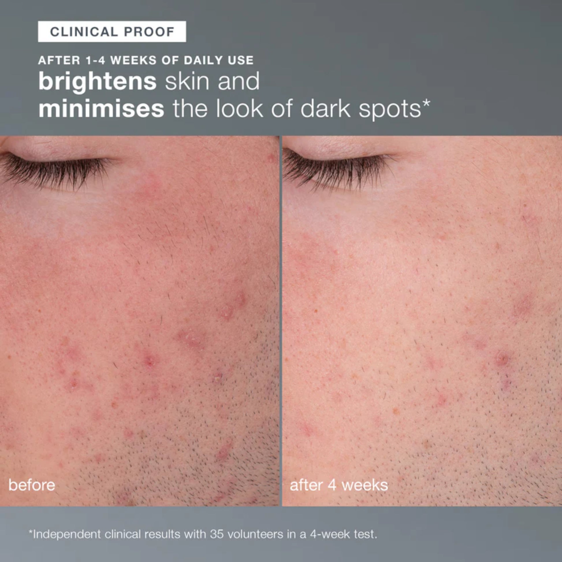 Dermalogica Daily Microfoliant