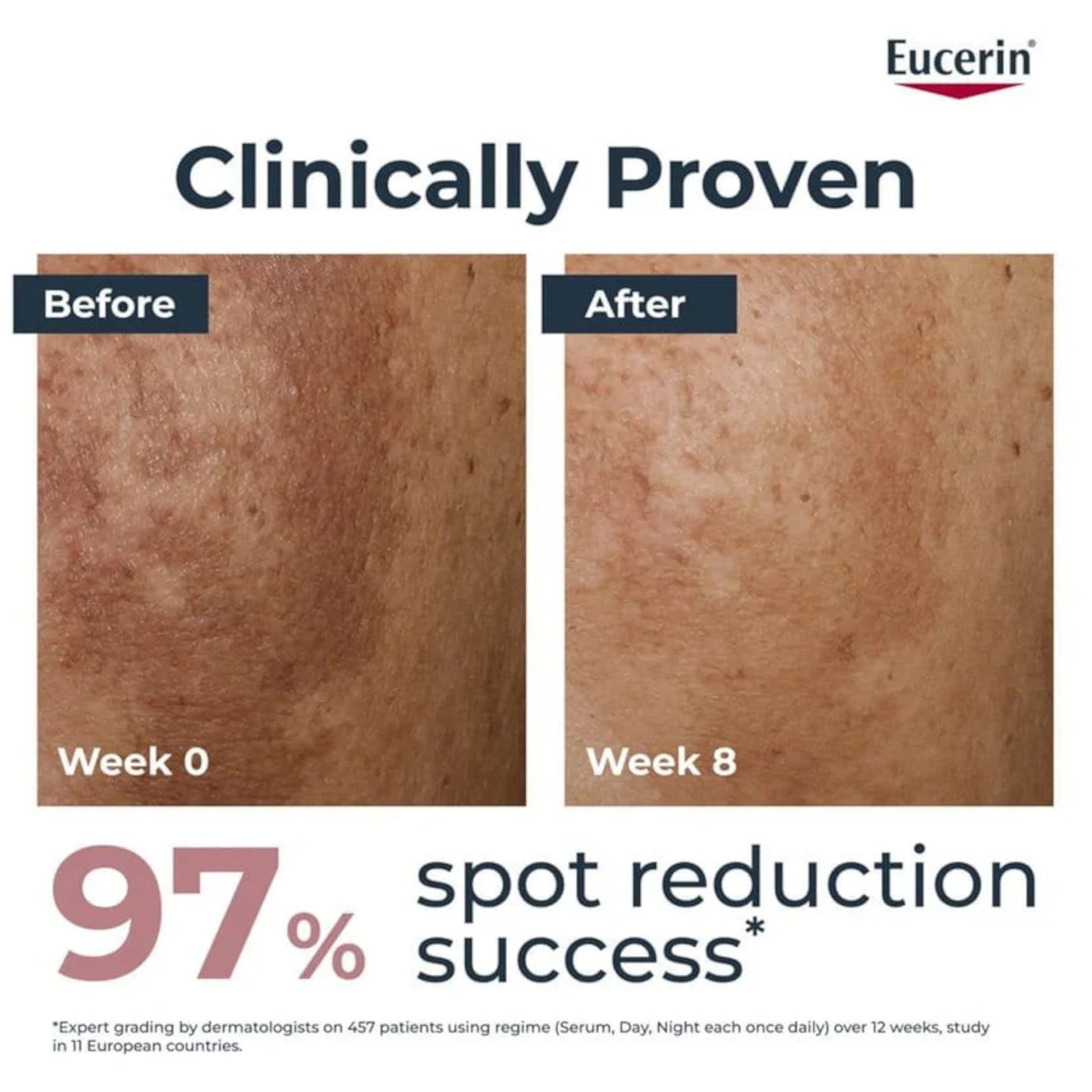 Eucerin Anti-Pigment Day Cream SPF30