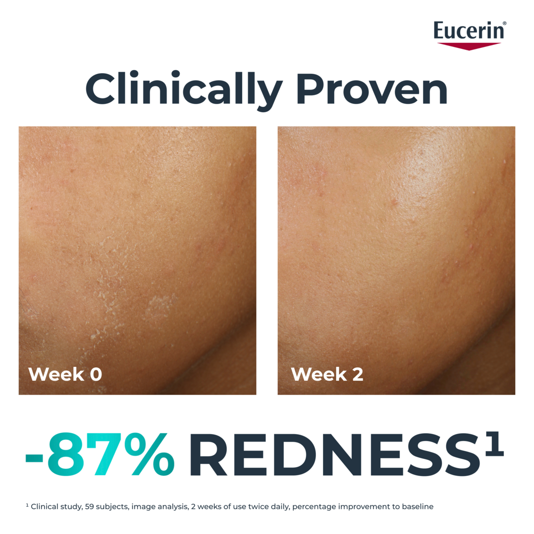 Eucerin Dermopure Hydra Repair Soothing Cream