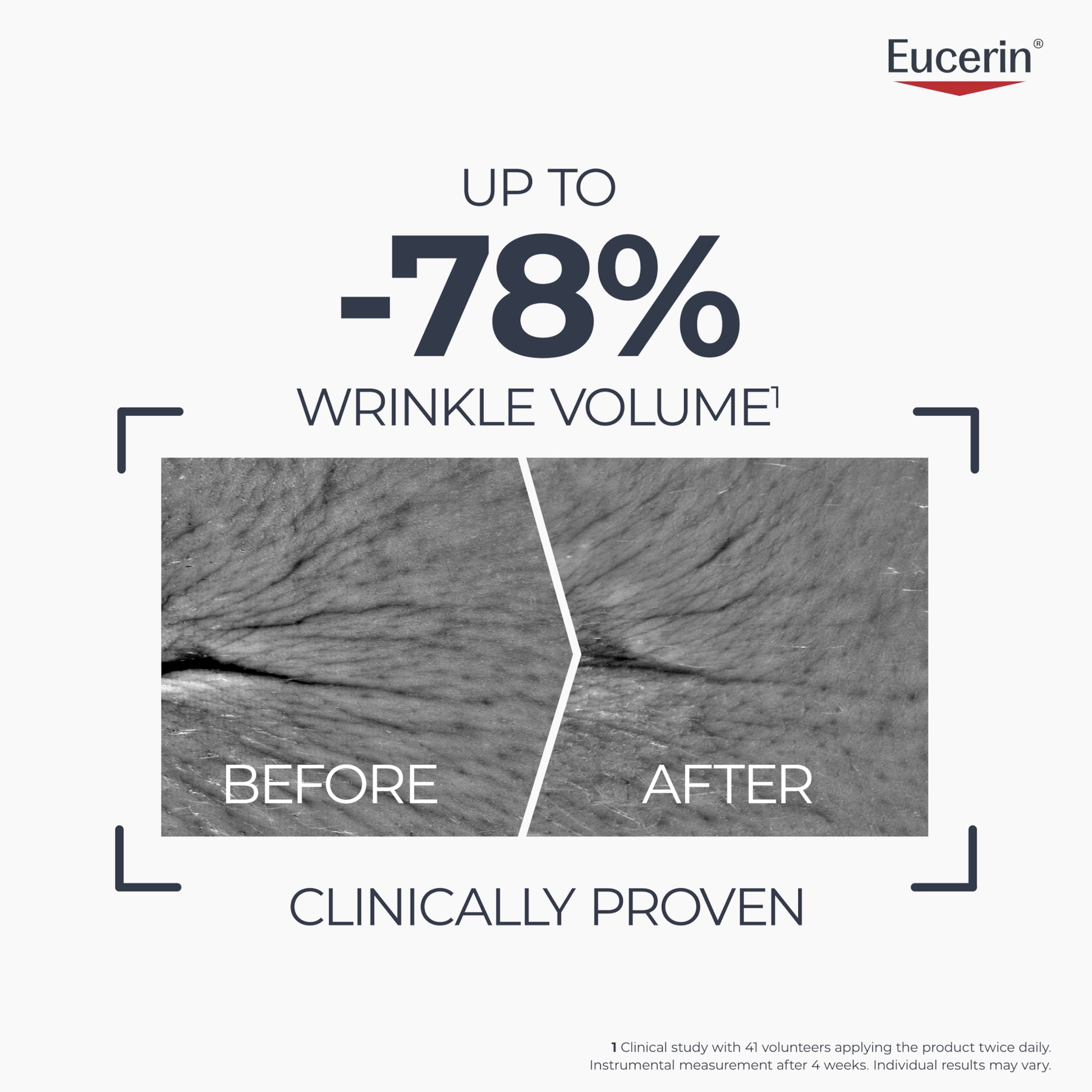 Eucerin Hyaluron-Filler + Longevity Epigenetic Serum