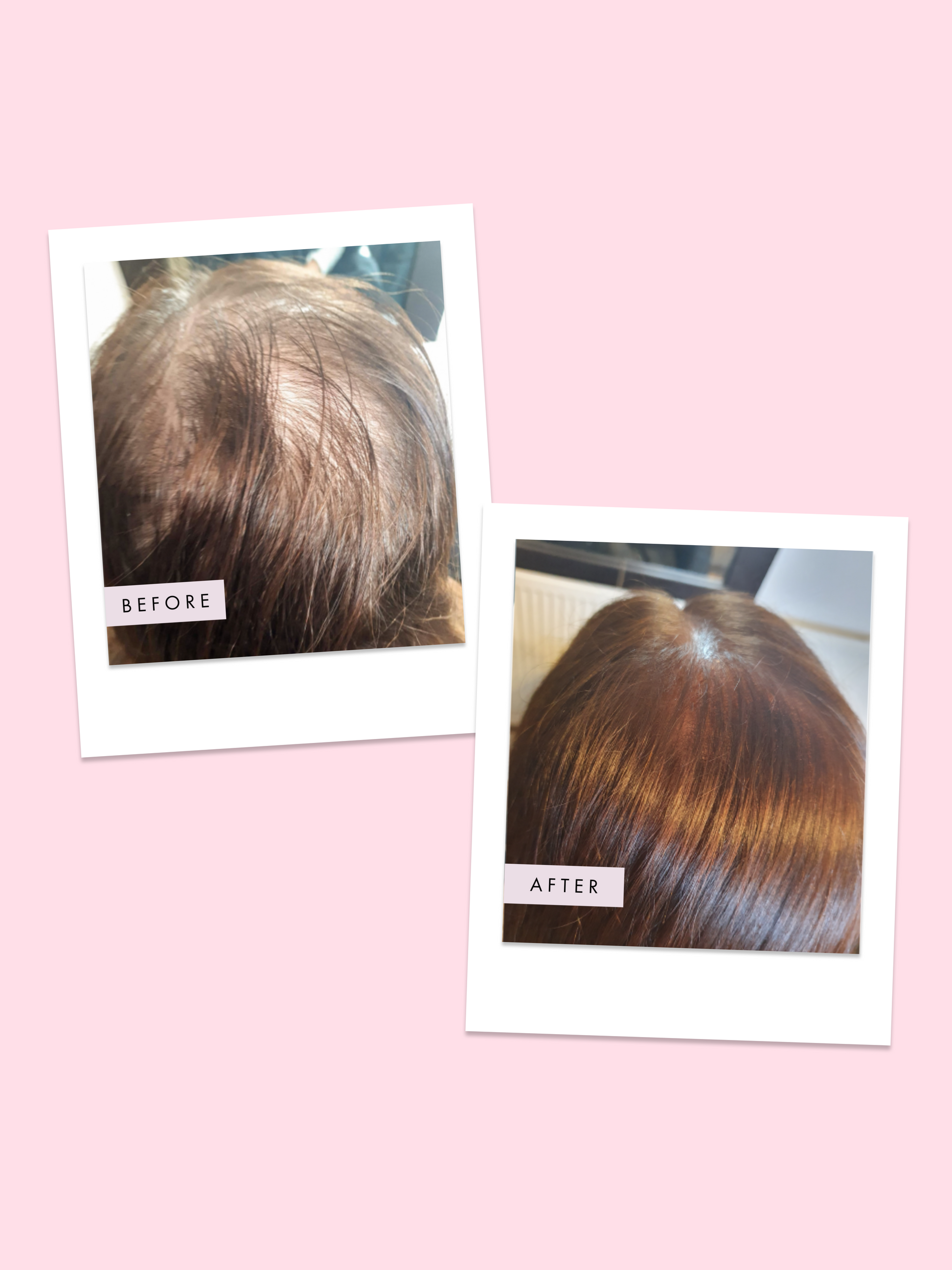 Hair Gain Vegan Hair Gummies Duo Set 2 x 60