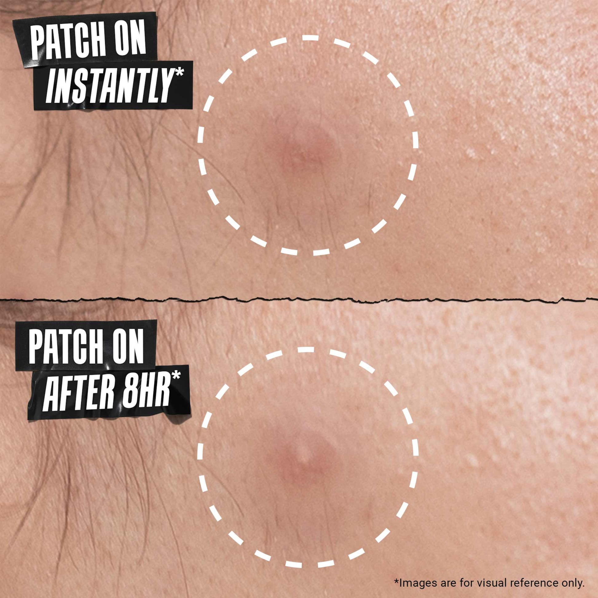 Kiehl's Truly Targeted Overnight Blemish Patch