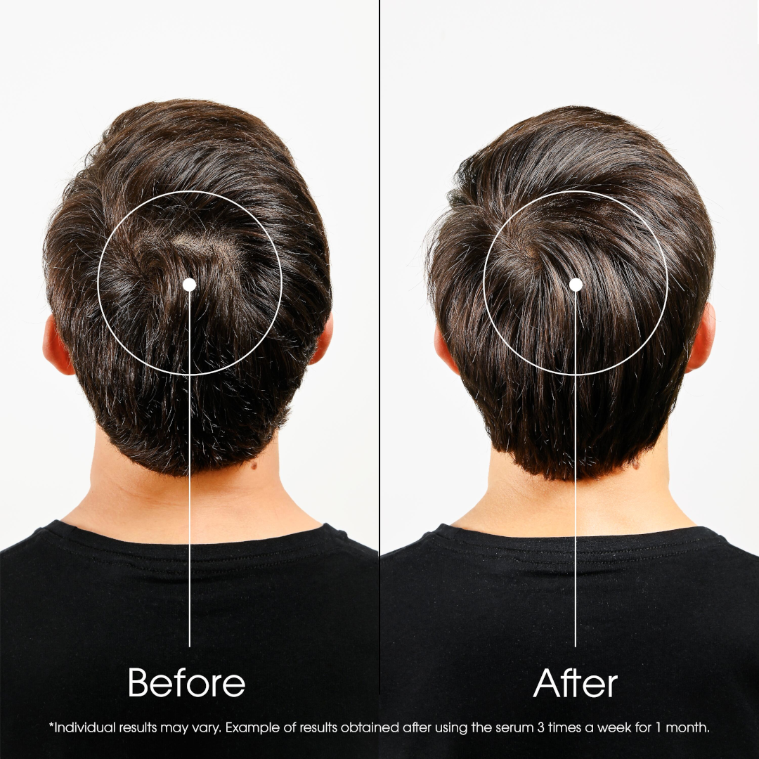 Klorane Quinine Hair Strengthening Serum