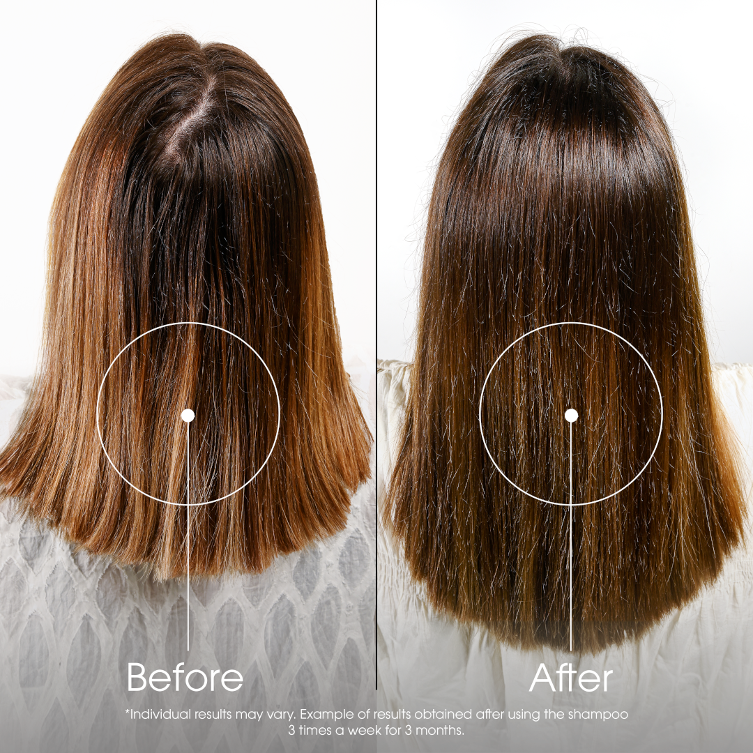 Klorane Quinine Shampoo for Thinning Hair