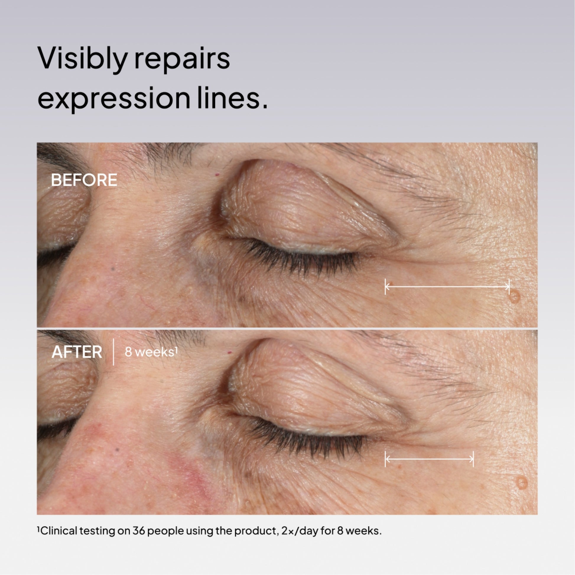 NIOD Fractionated Eye-Contour Concentrate