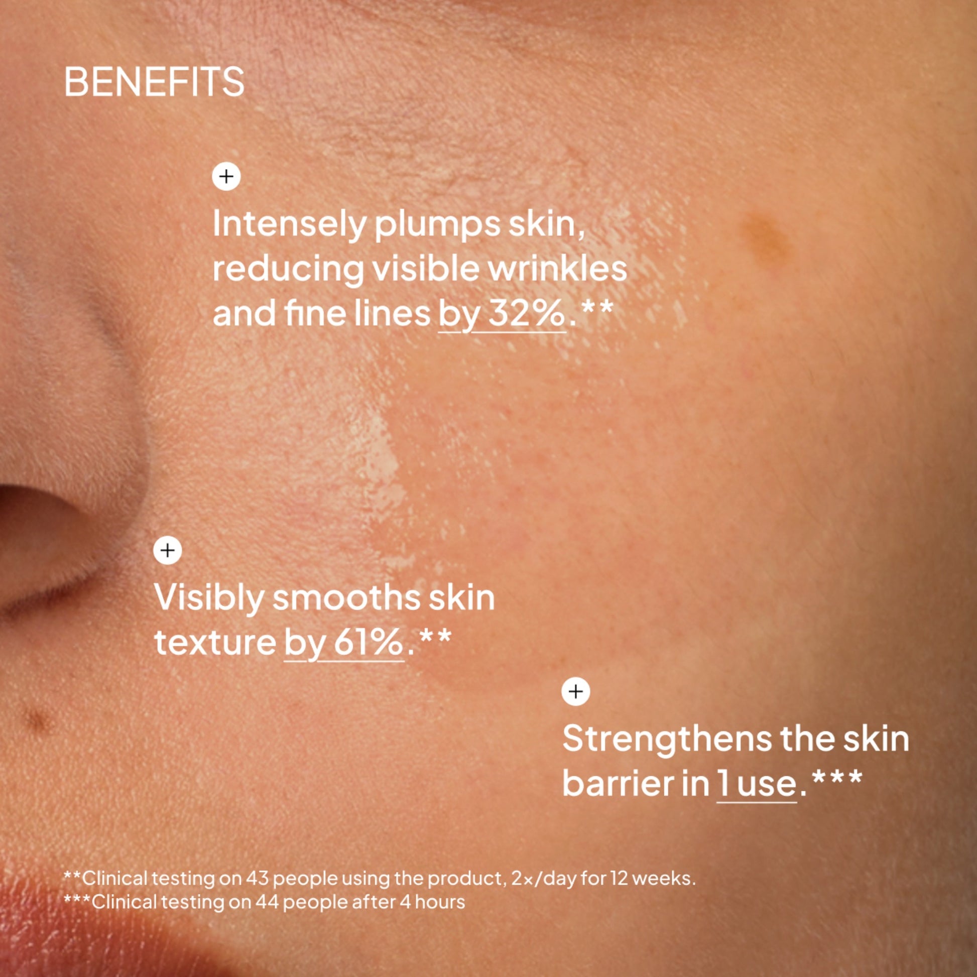 NIOD Multi-Molecular Hyaluronic Complex