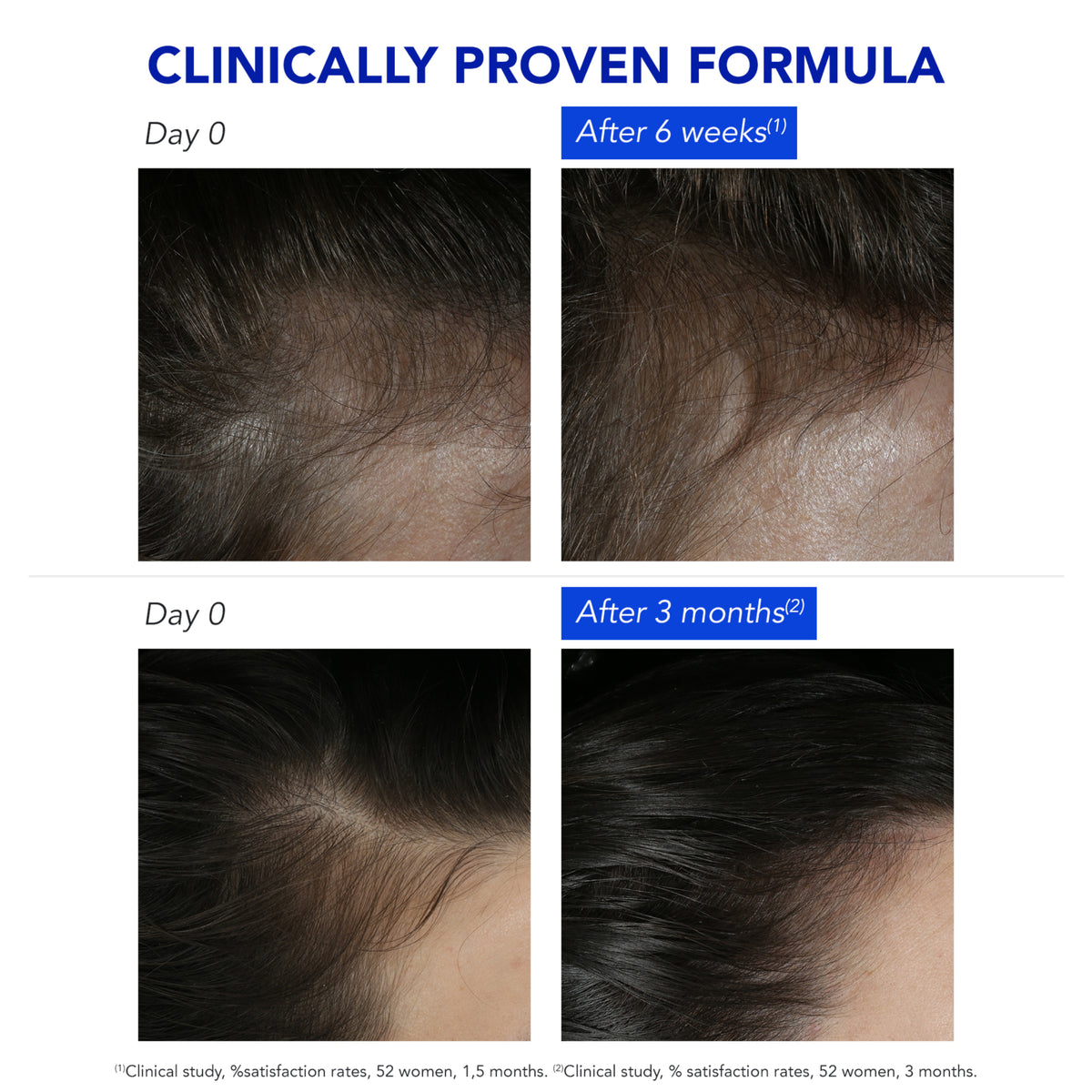 Phyto Phytocyane Anti-Reactive Hair Loss Treatment for Women