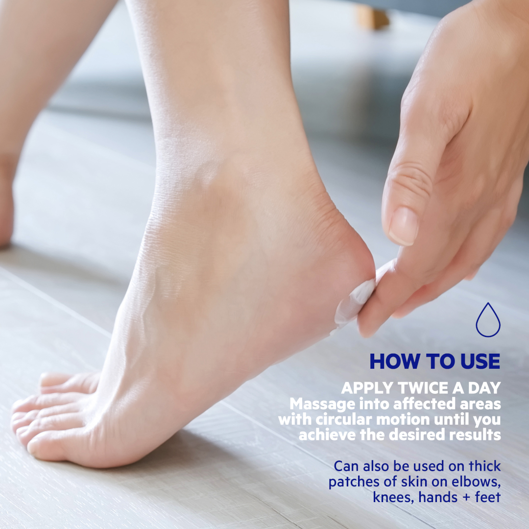 SVR Xerial 50 Extreme Foot Cream