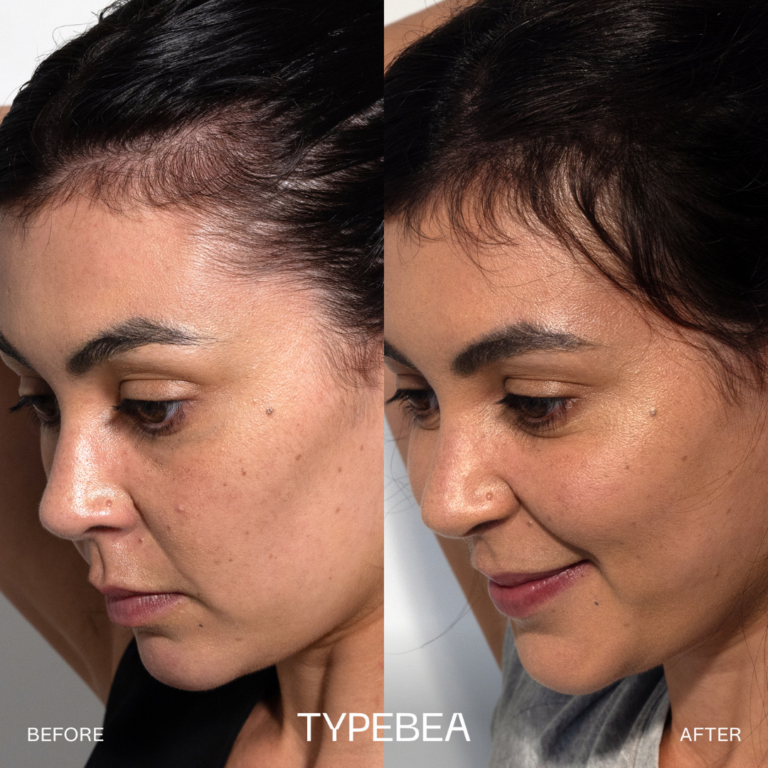 TYPEBEA G.1 Overnight Boosting Peptide Scalp Serum