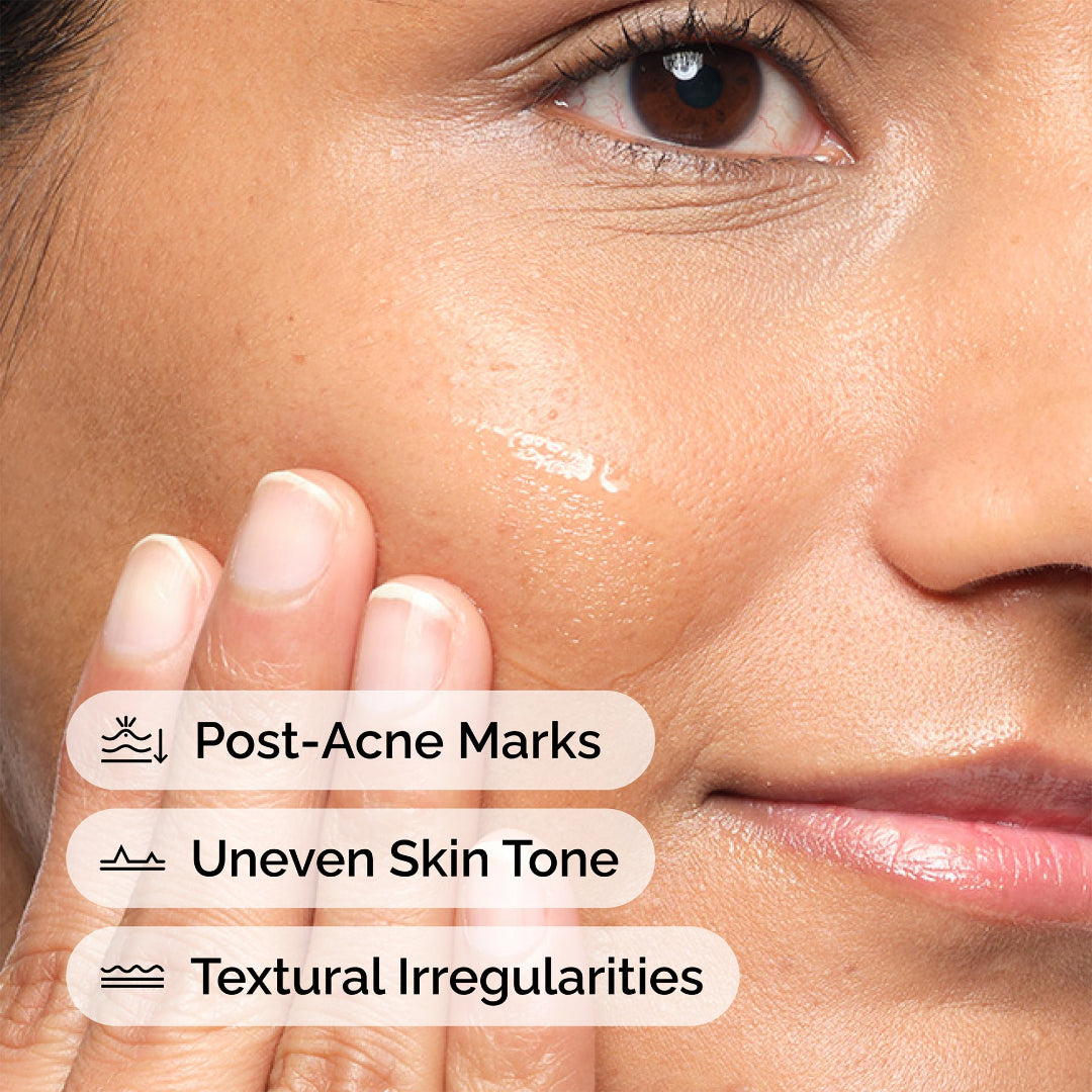 The Ordinary Aloe 2% + NAG 2% Solution