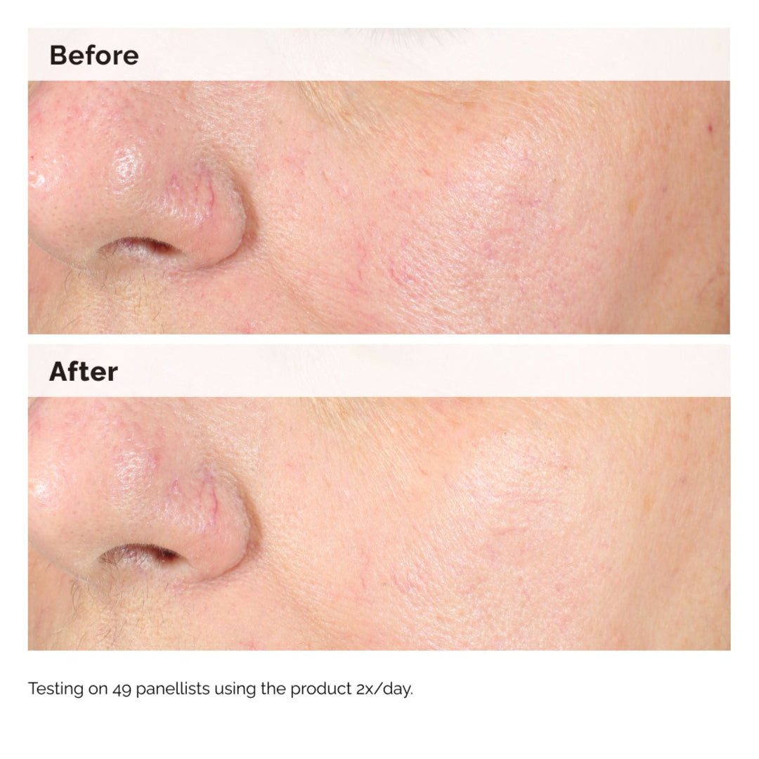 The Ordinary Alpha Arbutin 2% + HA