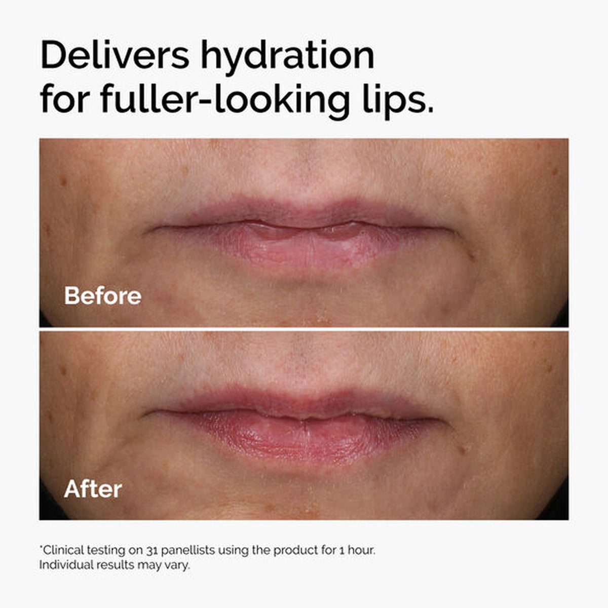 The Ordinary HA + Asiaticoside Lip Treatment