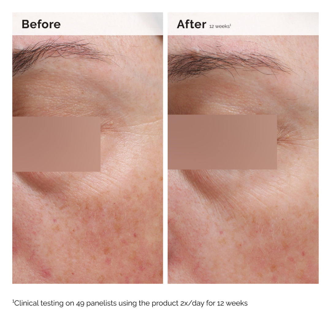 The Ordinary Niacinamide 5% Face and Body Emulsion