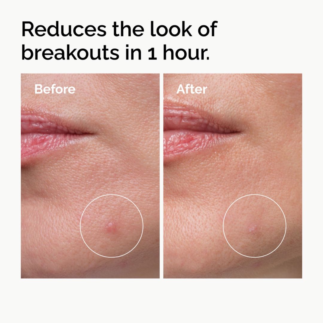 The Ordinary Sulfur 10% Powder-to-Cream Concentrate