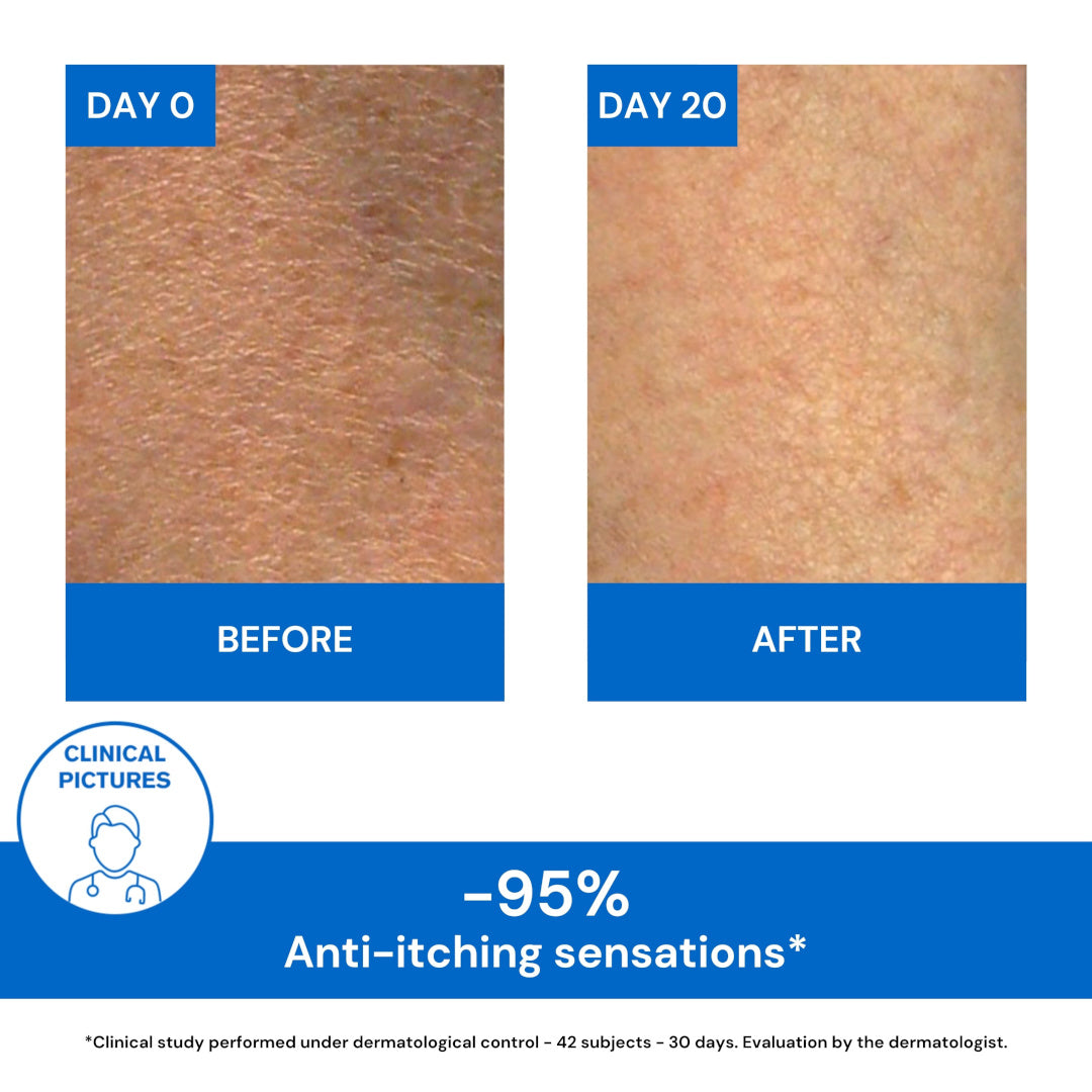 Uriage Xemose C8+ Lipid-Replenishing Anti-Itch Cream