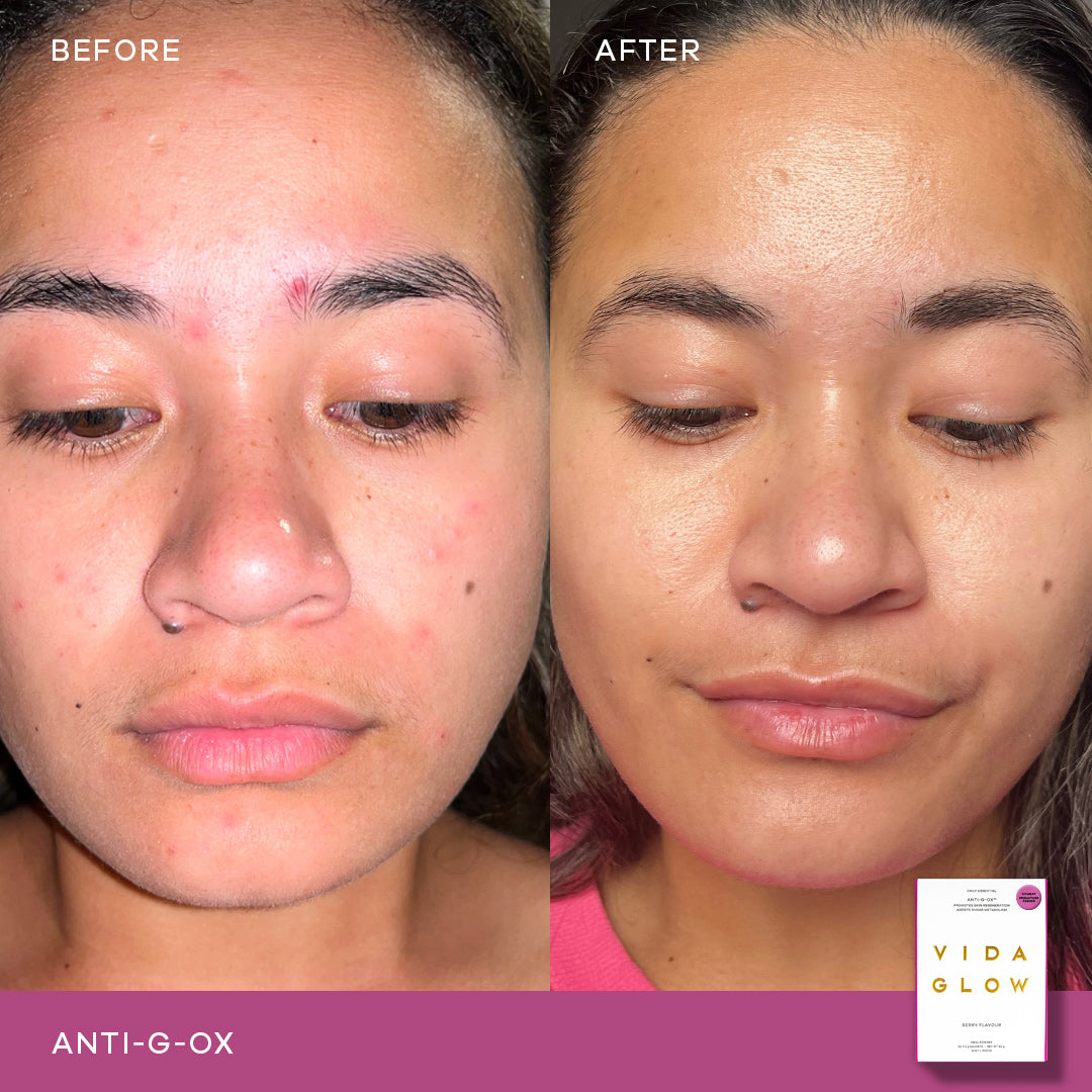 Vida Glow Anti-G-Ox Sachets - Berry Flavour