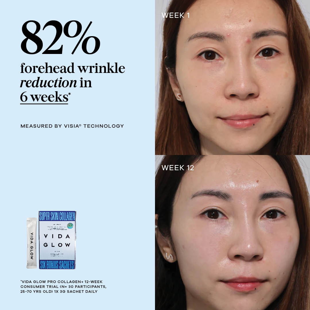 Vida Glow Pro Collagen+ Sachets - Original Flavour Bonus Set