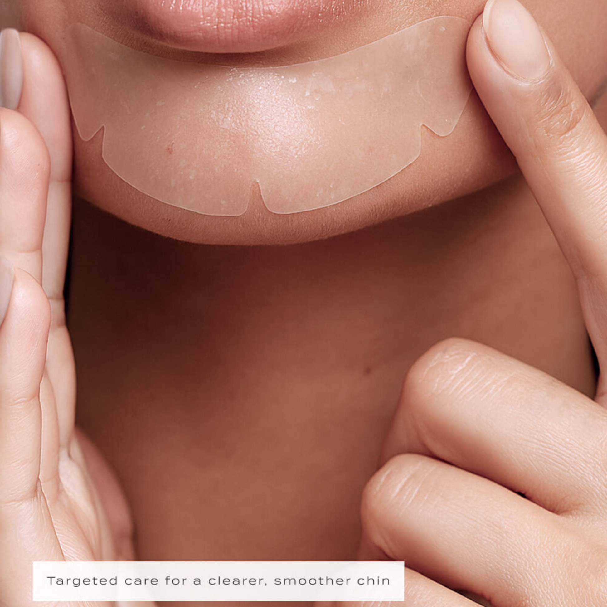 Vue Chin Patches