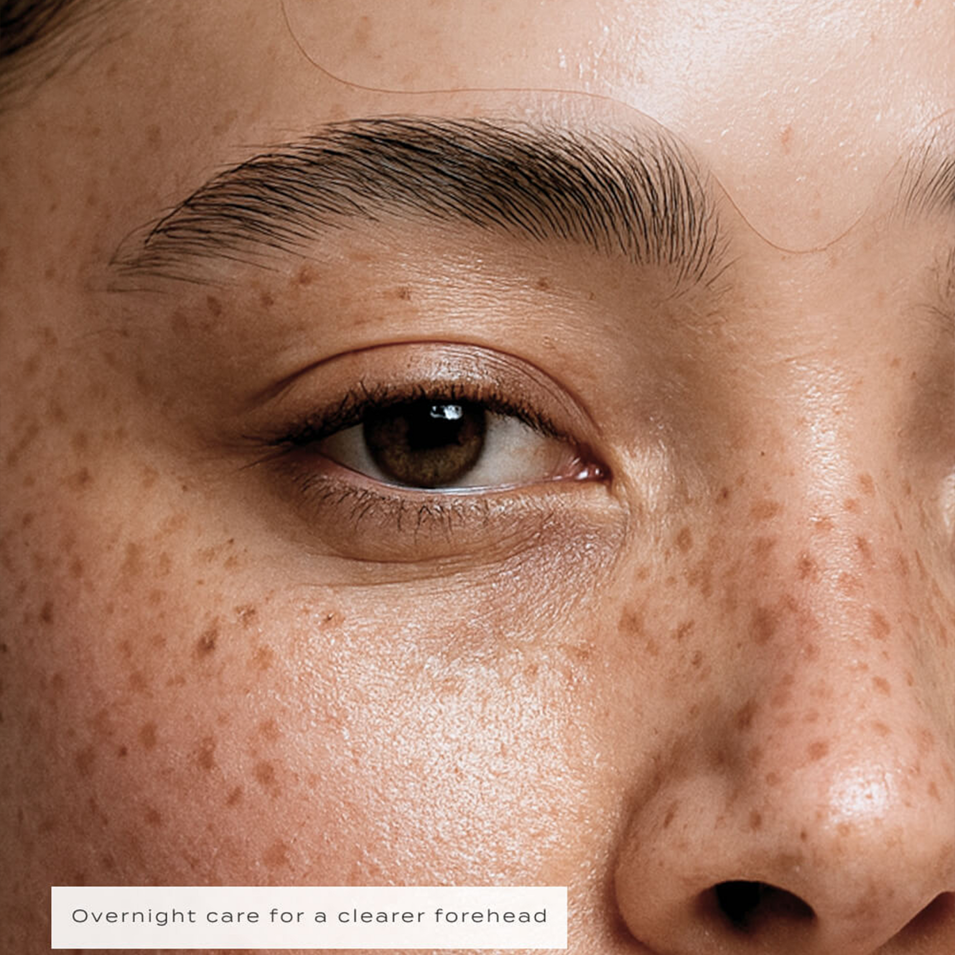 Vue Forehead Patches