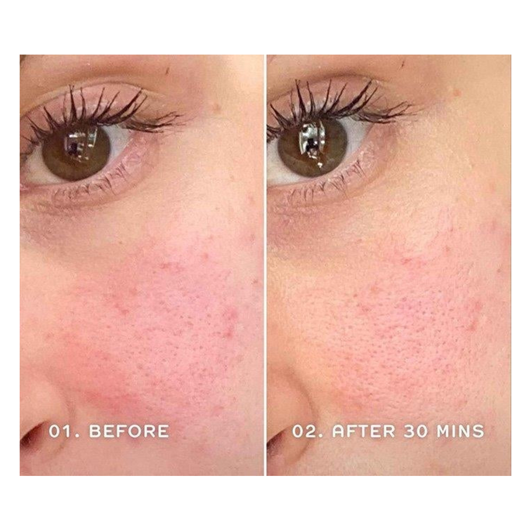 REN Evercalm Redness Relief Serum