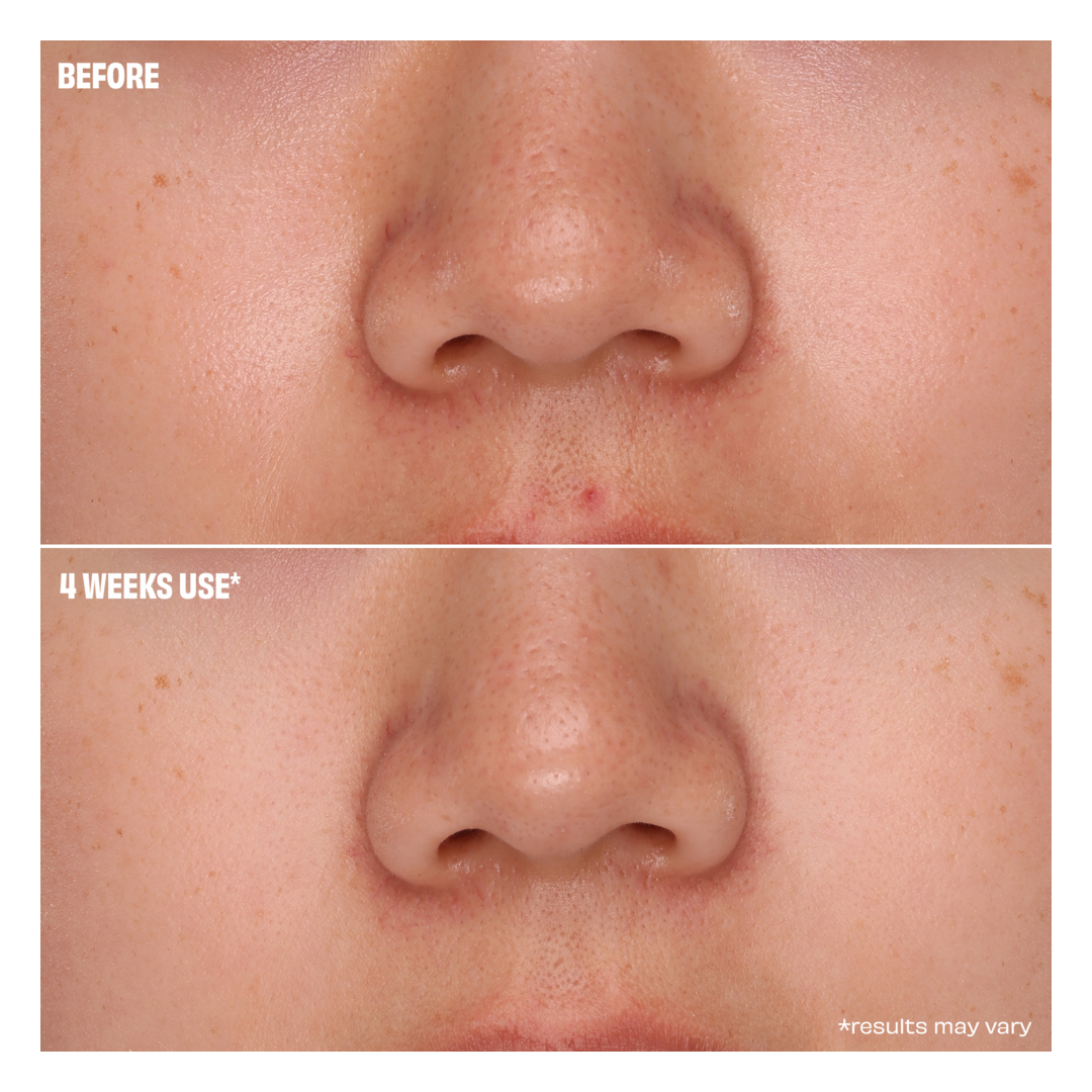 Benefit All You Knead is Pore Care Gift Set