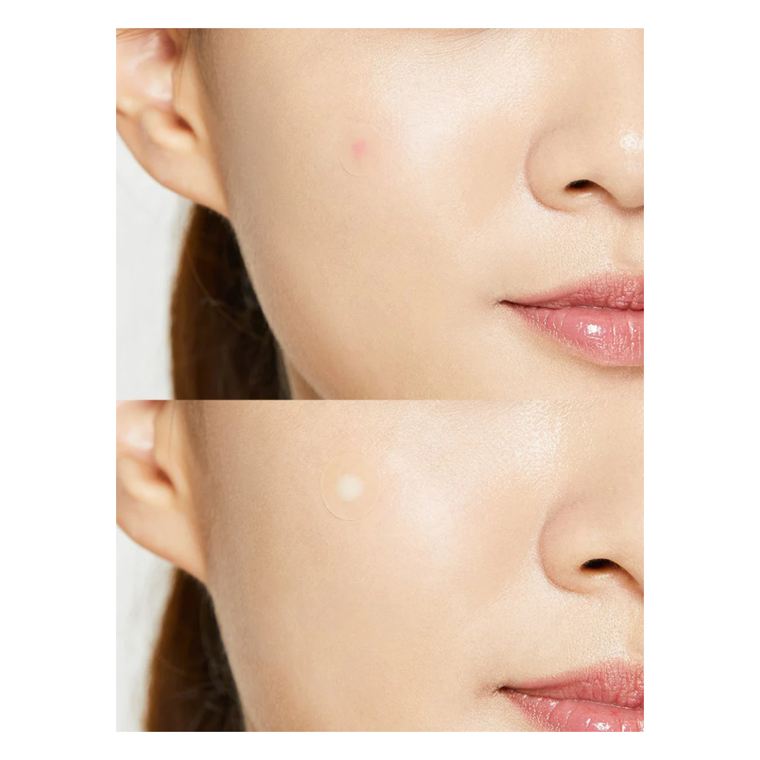 COSRX Acne Pimple Master Patch 24 Patches