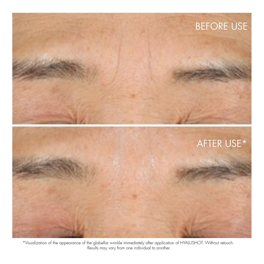 DIOR Capture Totale Hyalushot Wrinkle Corrector