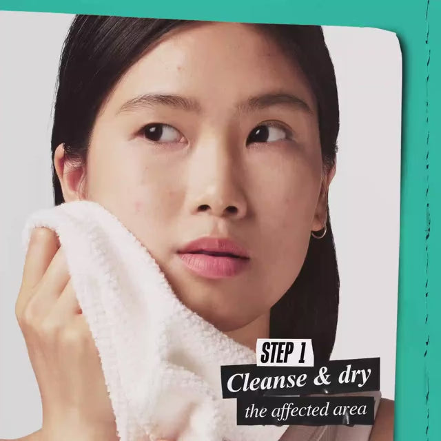 Kiehl's Truly Targeted Overnight Blemish Patch