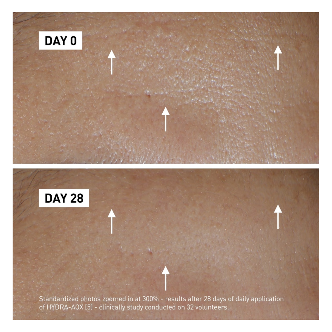 Filorga Hydra-Aox [5] Intensive Antioxidant Serum