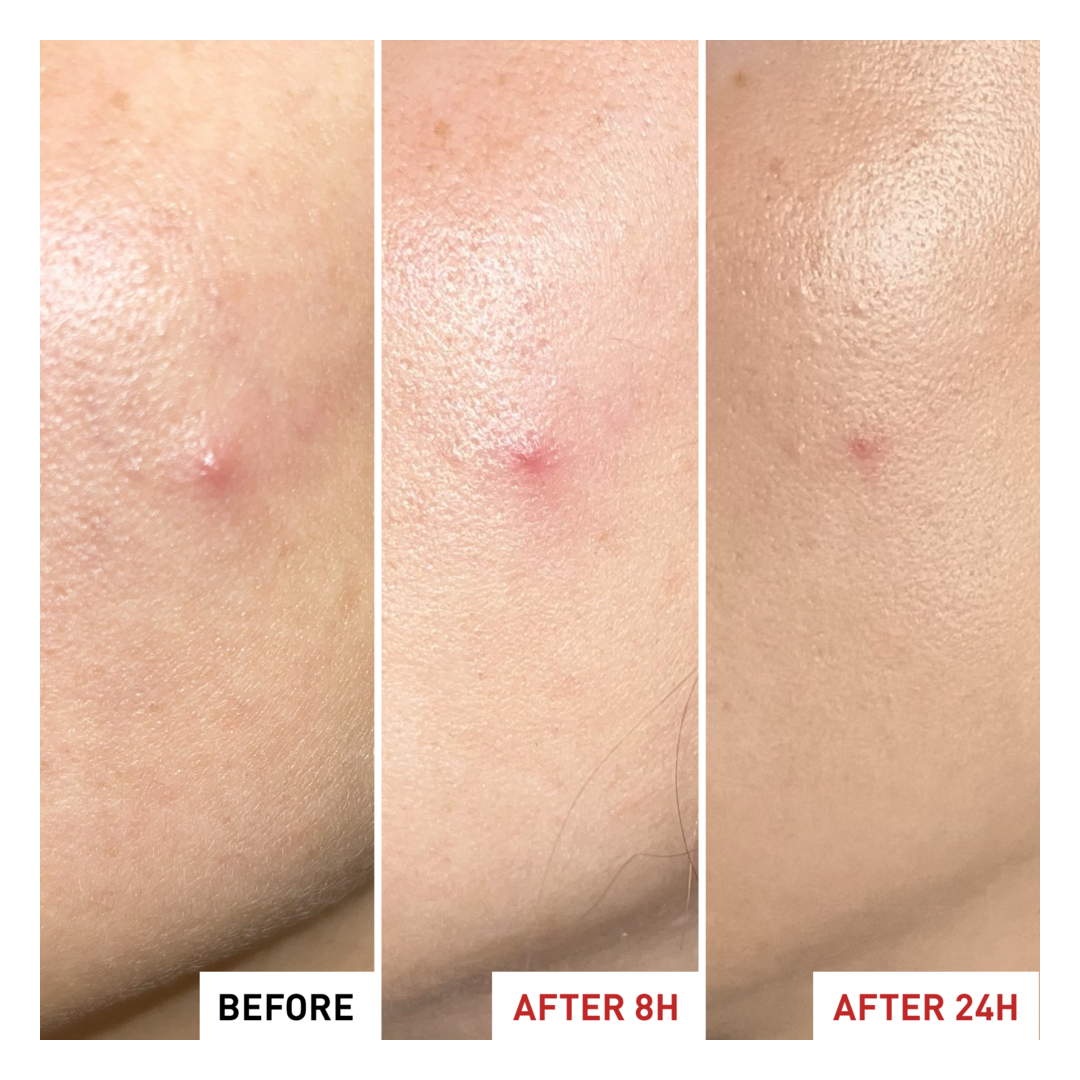 Erborian Centella SOS Patch